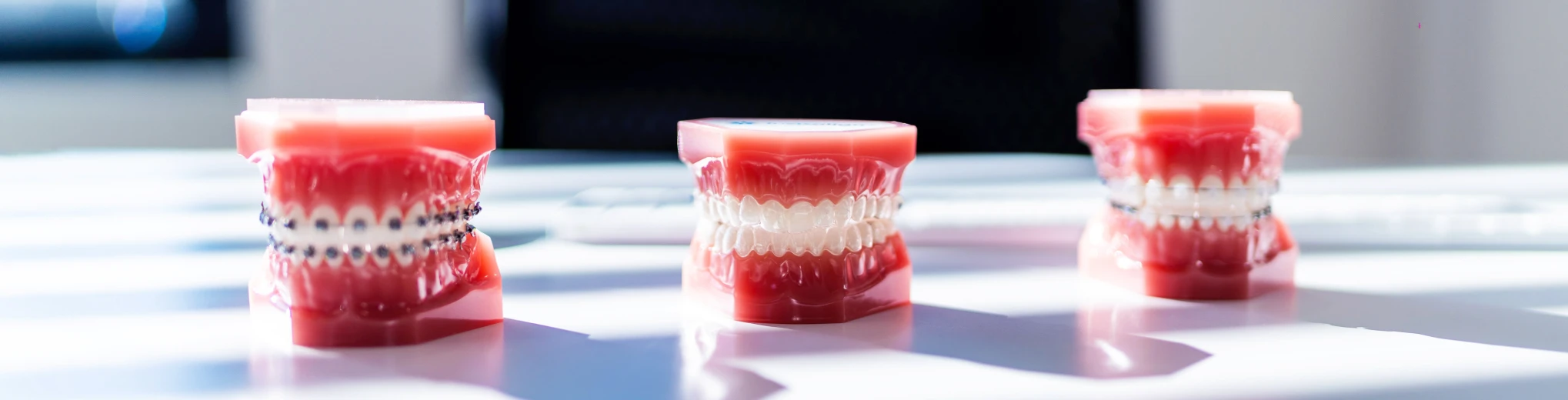 Orthodontiste près de Saint-Louis